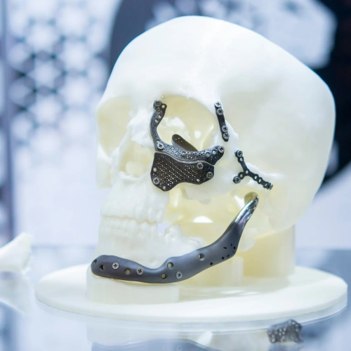 titanium medical implants